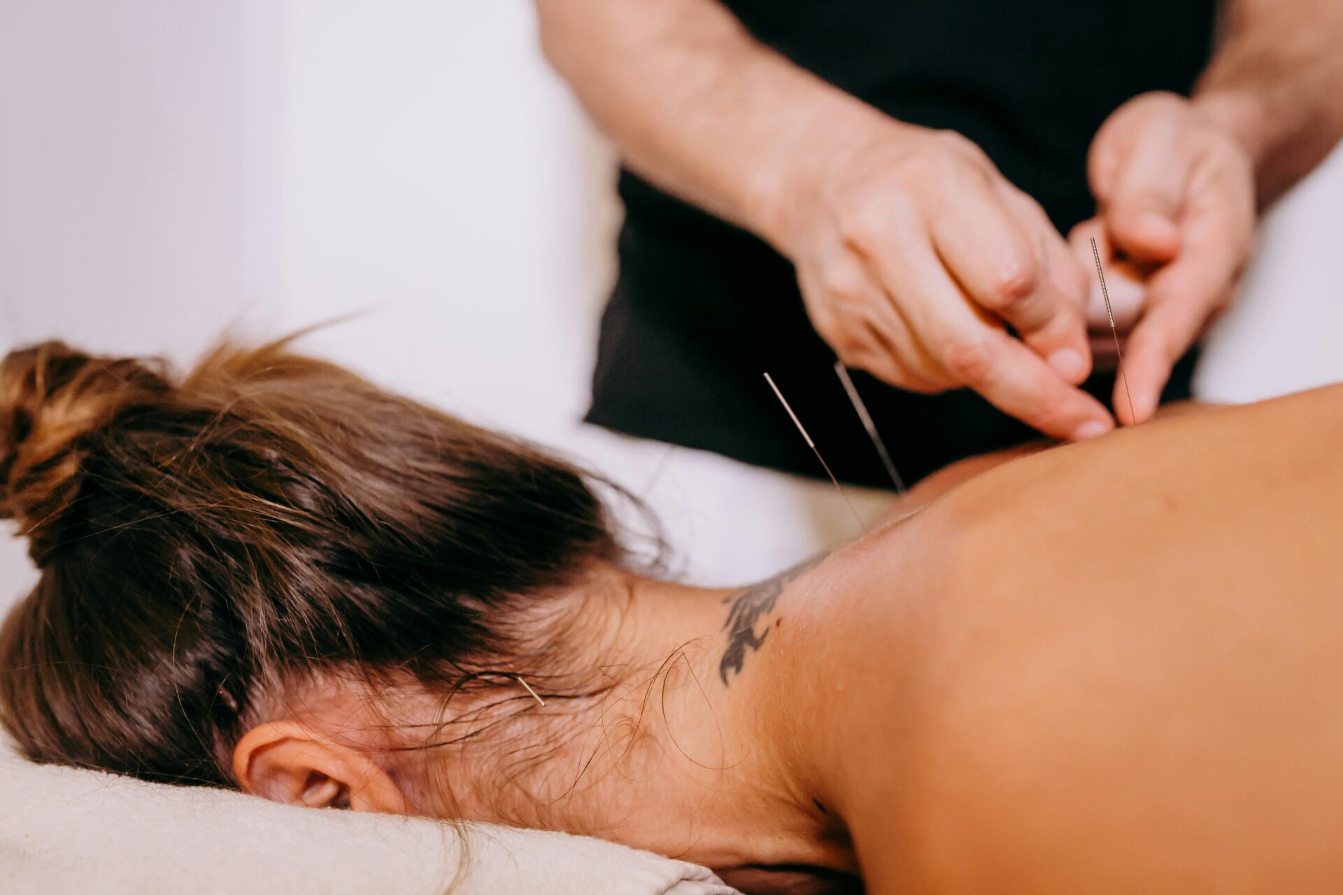 A girl receiving a massage, symbolizing athletic recovery and performance enhancement with acupuncture